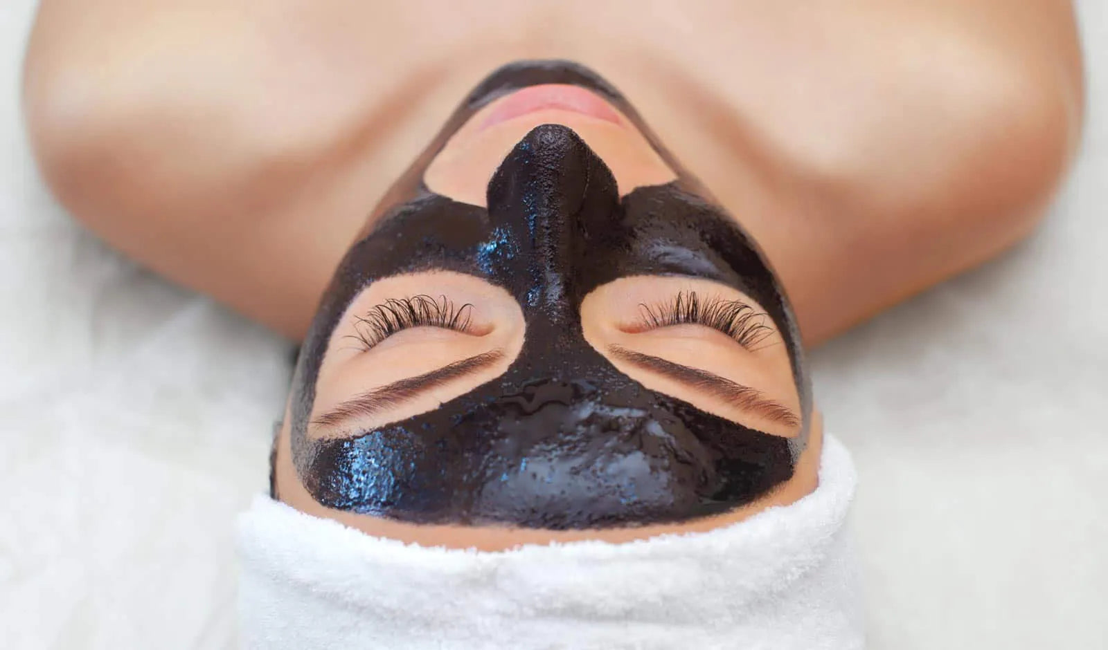 CARBON LASER FACIALS NOW AVAILABLE AT LASERHQ