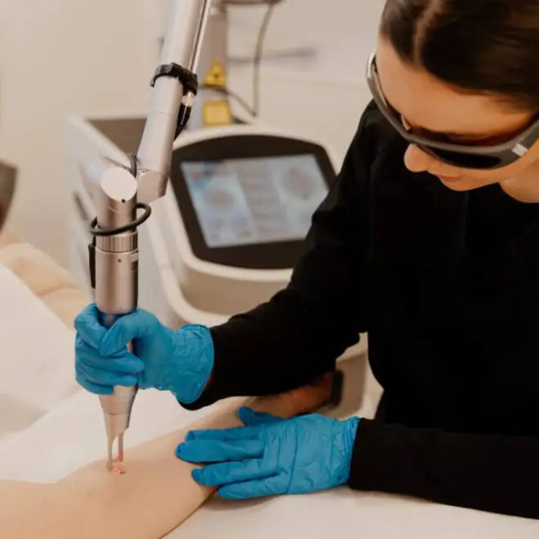 Laser Tattoo & Pigmentation Removal launches at all LaserHQ Clinics