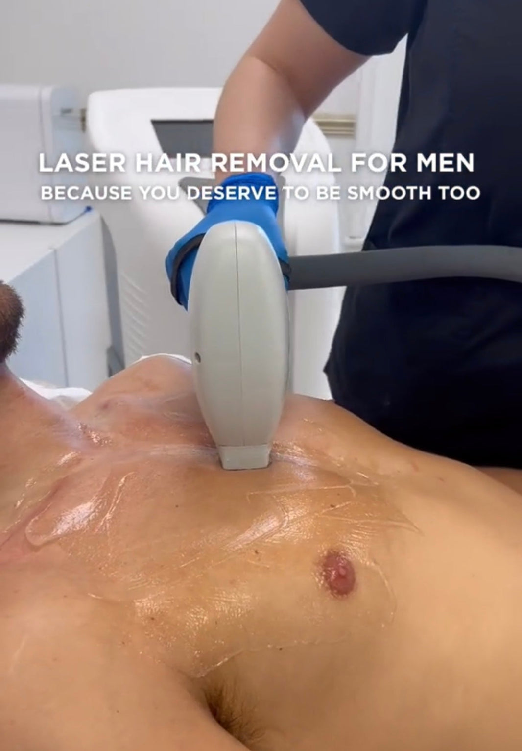 Men's Laser Hair Removal — The Grooming Game Changer You Need to Know About