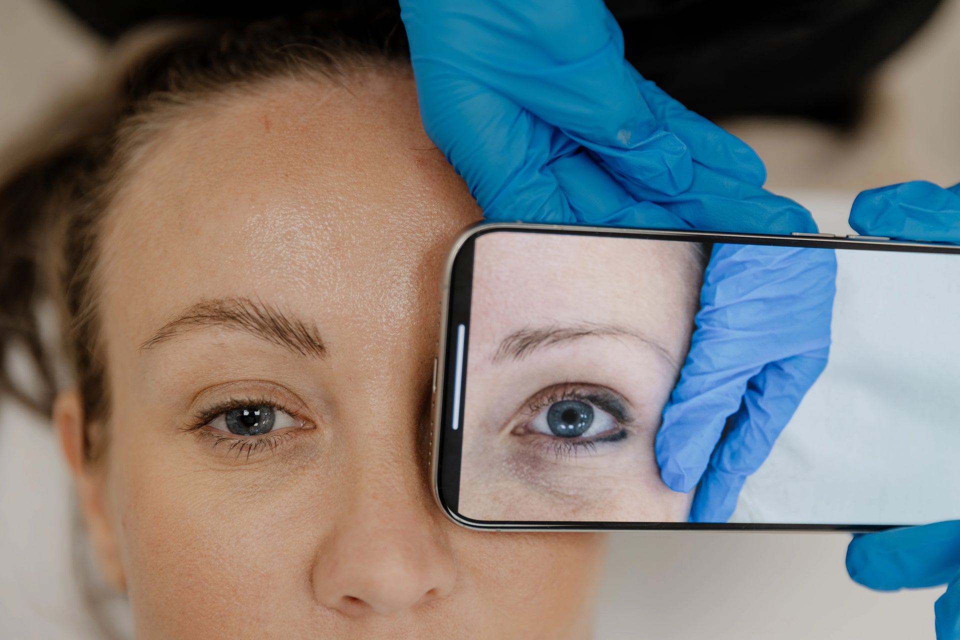 Eyeliner Tattoo Removal - LaserHQ-MARCA-MEDIA