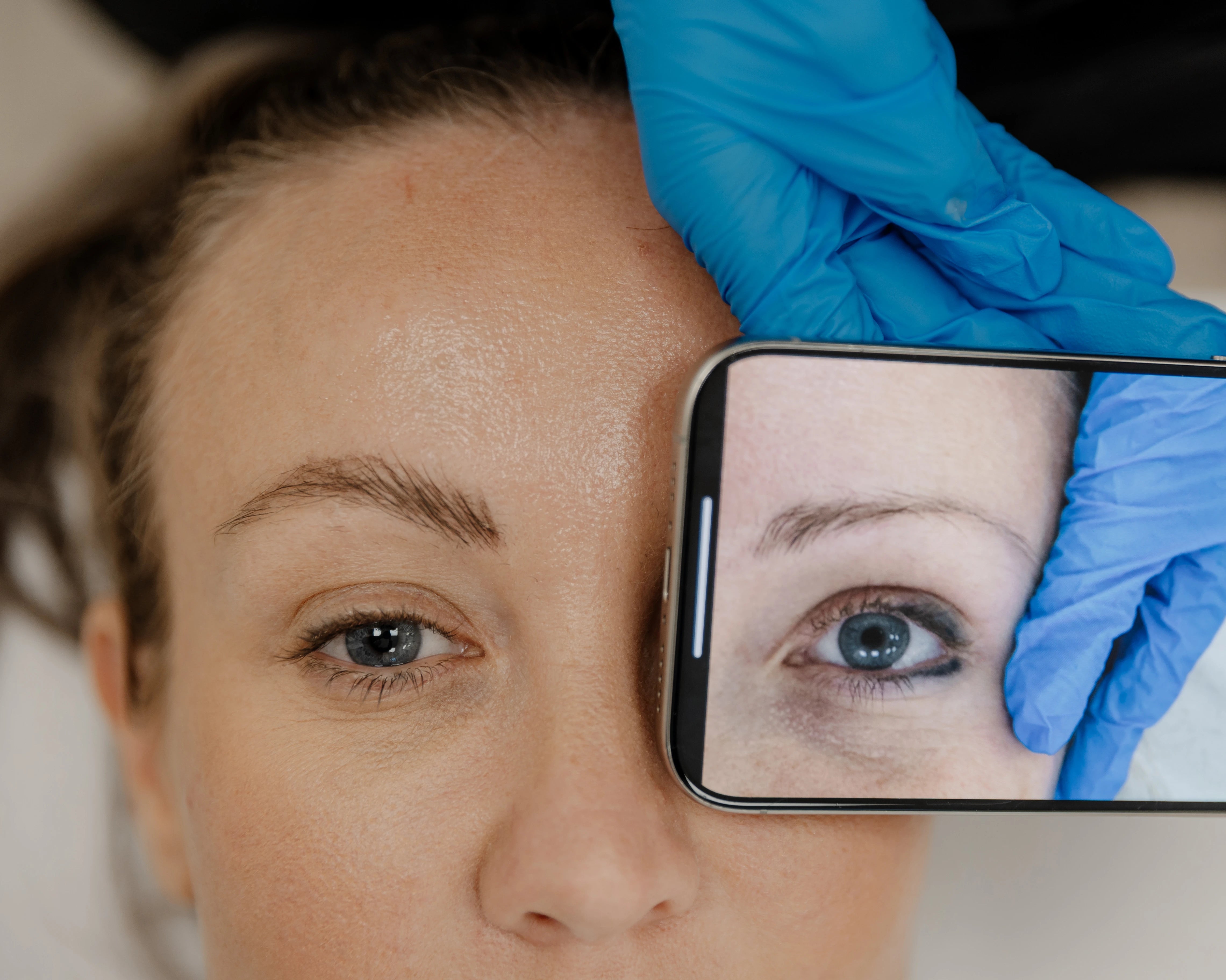 Eyeliner Tattoo Removal - LaserHQ-MARCA-MEDIA