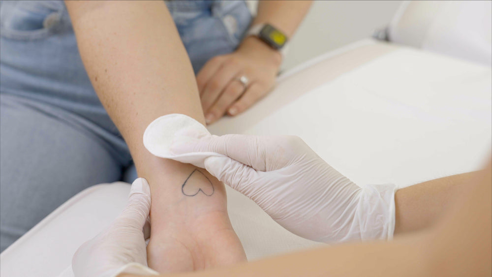 Tattoo Removal - LaserHQ-MARCA-MEDIA